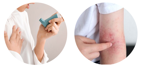 喘息・アトピー 喘息・アトピー